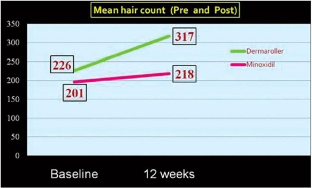 Die Anzahl der Haare steigt durch die Verwendung eines Dermarollers dramatisch an