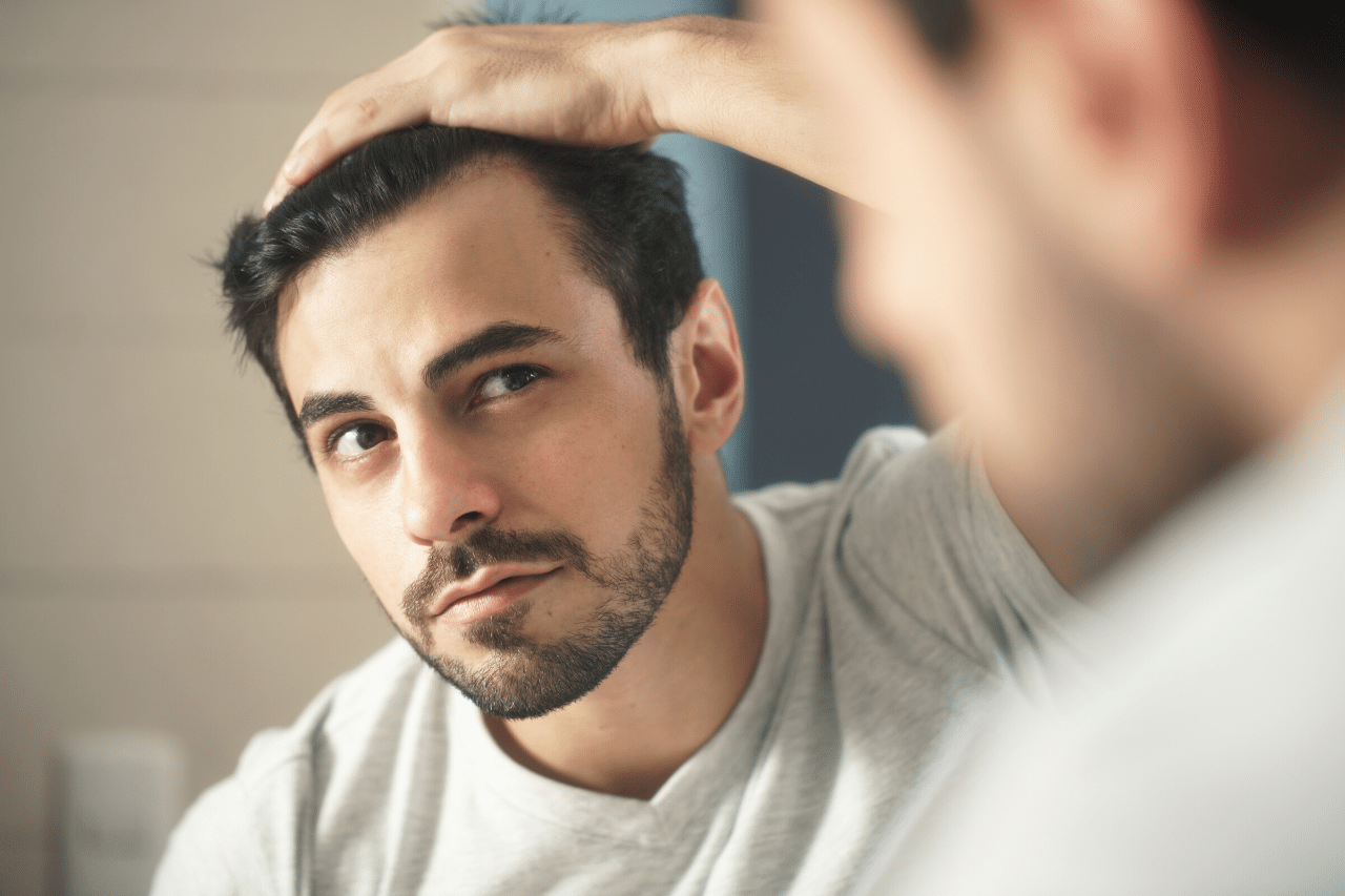 Finasterid gegen Geheimratsecken und zurückweichenden Haaransatz