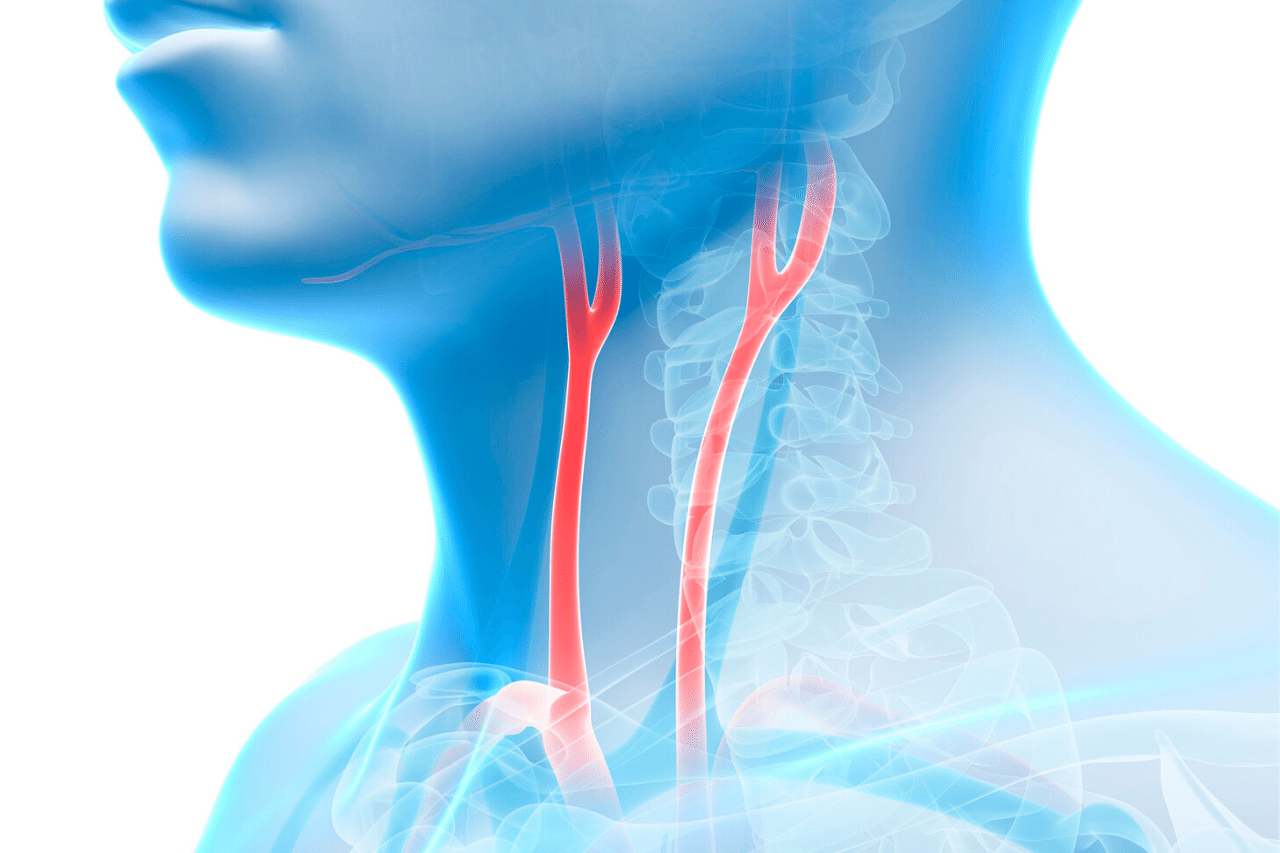 Die Halsschlagader ist der Transportweg für Blut zum Gehirn und zur Kopfhaut