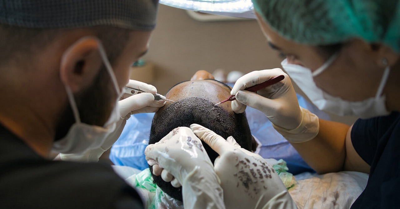 Haartransplantation Todesfälle Kann man bei einer Haartransplantation sterben